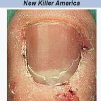 Will HuntNew Killer America (Album 2001)