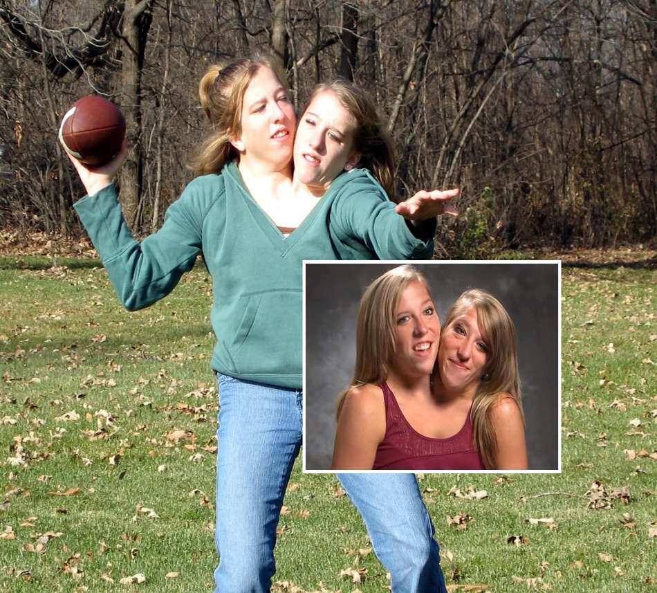 Abby And Brittany Hensel Conjoined Twins Defying The Odds Notednames 