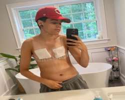He received a reconstructive surgery on his chest in October 2021.