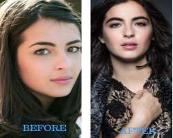 Alanna Masterson before surgery