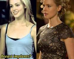 Amanda Schull before surgery