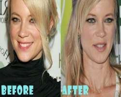 Amy Smart before surgery