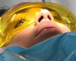 Becky got a dental treatment in March 2019.