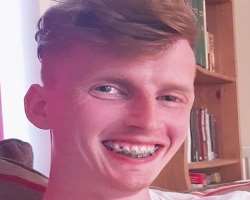 The star used braces to correct his teeth.