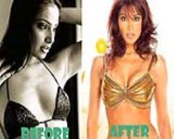 Bipasha Basu before surgery