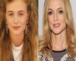 Heather Graham before surgery