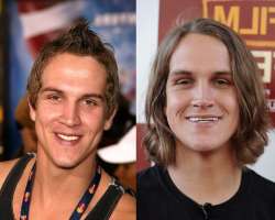 Jason Mewes before surgery