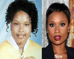 Jennifer Hudson before surgery