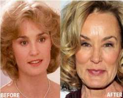 Jessica Lange before surgery