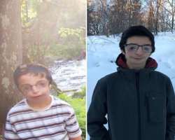 He is diagnosed with Treacher Collins Syndrome which may impact his eye sighting, hearing abilities, and cleft palate He is diagnosed with Treacher Collins Syndrome which may impact his eye sighting, hearing abilities, and cleft palate.