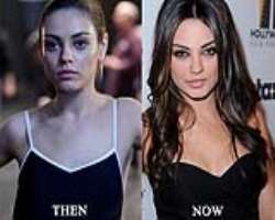 Mila Kunis before surgery