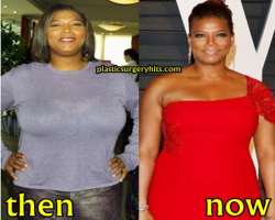 Queen Latifah Plastic Surgery Nose