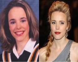 Rachel McAdams before surgery