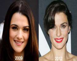 Rachel Weisz before surgery