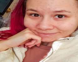 She has been a long-time sufferer of acne on her face.