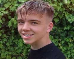 He used braces to correct his teeth.
