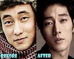 So Ji-sub before surgery