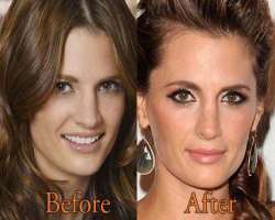 Stana Katic before surgery