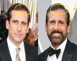 Steve Carell before surgery Steve Carell before surgery