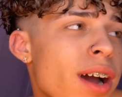 He uses braces to correct his teeth.