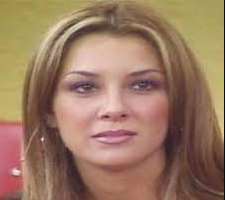 Elizabeth Gutierrez before surgery