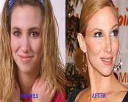 Debbie Gibson before surgery