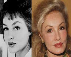 Julie Newmar before surgery