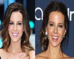 Kate Beckinsale before surgery