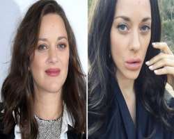 Marion Cotillard before surgery