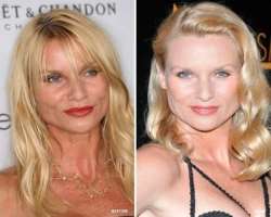 Nicollette Sheridan before surgery Nicollette Sheridan before surgery