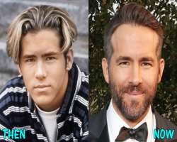 Ryan Reynolds before surgery