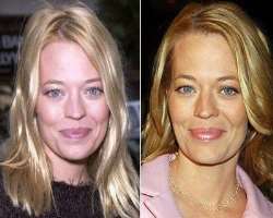 Jeri Ryan after surgery Jeri Ryan after surgery