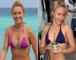 Hayden Panettiere before surgery