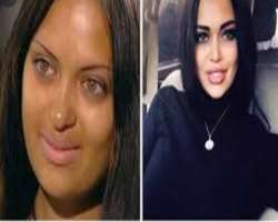 Nita Kuzmina before surgery