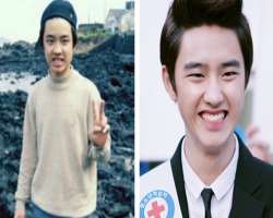 D.O. (Entertainer) before surgery