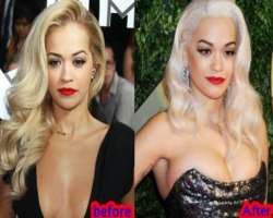 Rita Ora before surgery